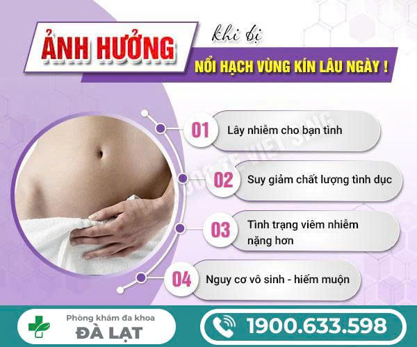Hình ảnh minh họa